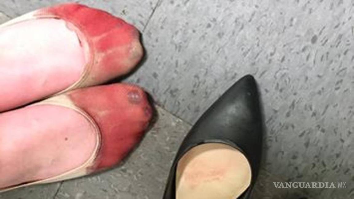 Polémica en Facebook: Meseras son obligadas a llevar tacones aunque les destrocen los pies