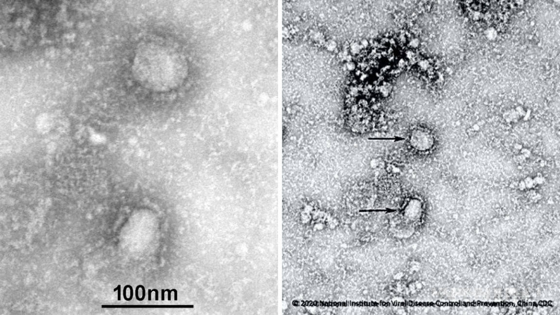 Estas son las imágenes del mortal coronavirus que se esparce por China