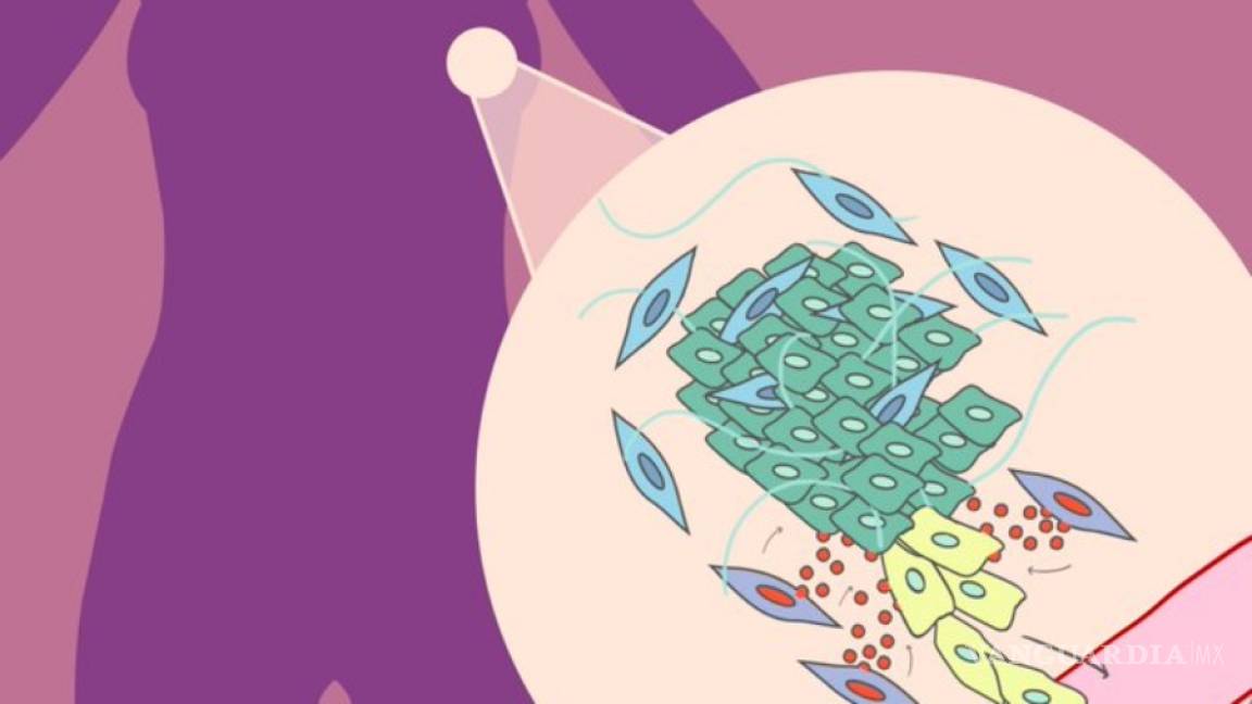 Un gen de células que rodean los tumores, clave en avance del cáncer de mama