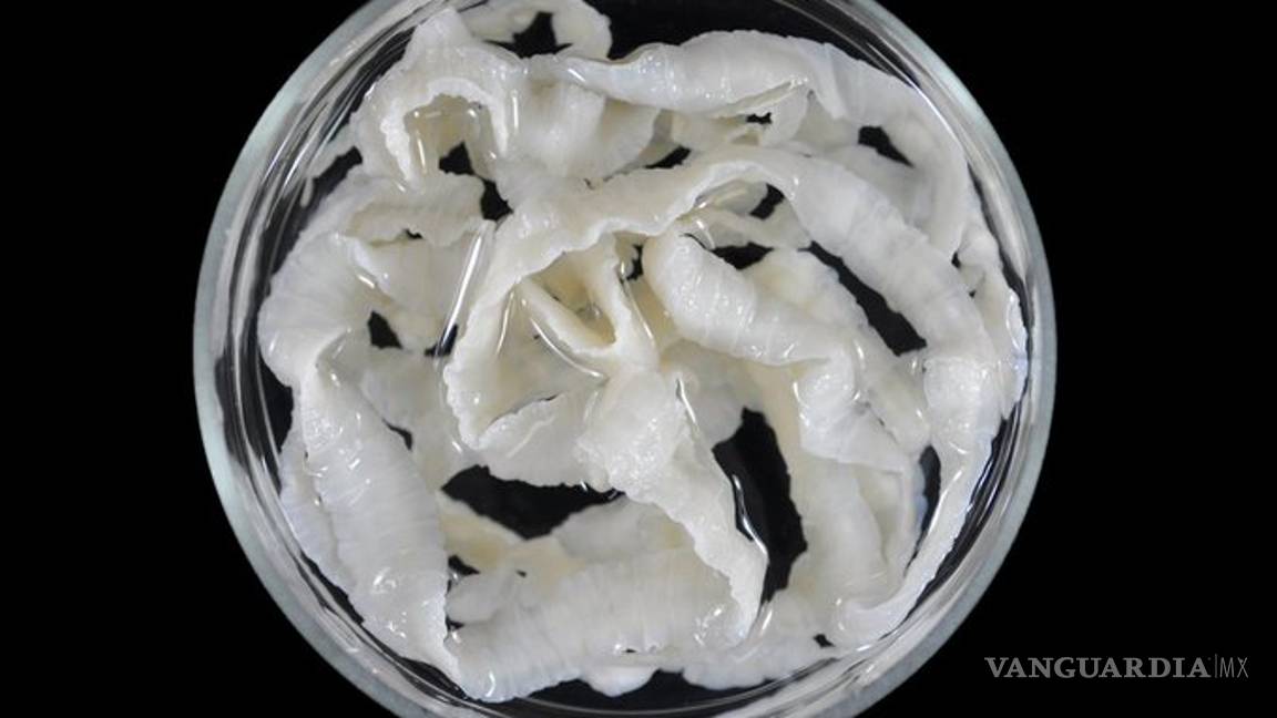 $!Actor de ‘El Señor de los Cielos’ murió por bacteria letal en carne de cerdo