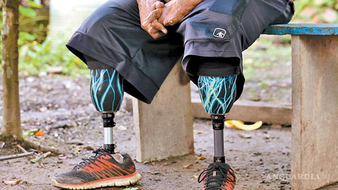 $!Quemados por el huachicol... los 19 mil heridos por el fuego en Puebla e Hidalgo