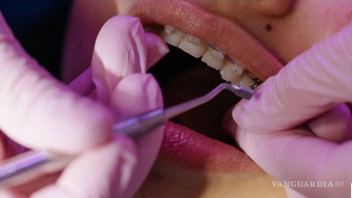 Coahuila: Especialízate en Ciencias Odontológicas con acentuación en Ortodoncia; la UAdeC impartirá maestría