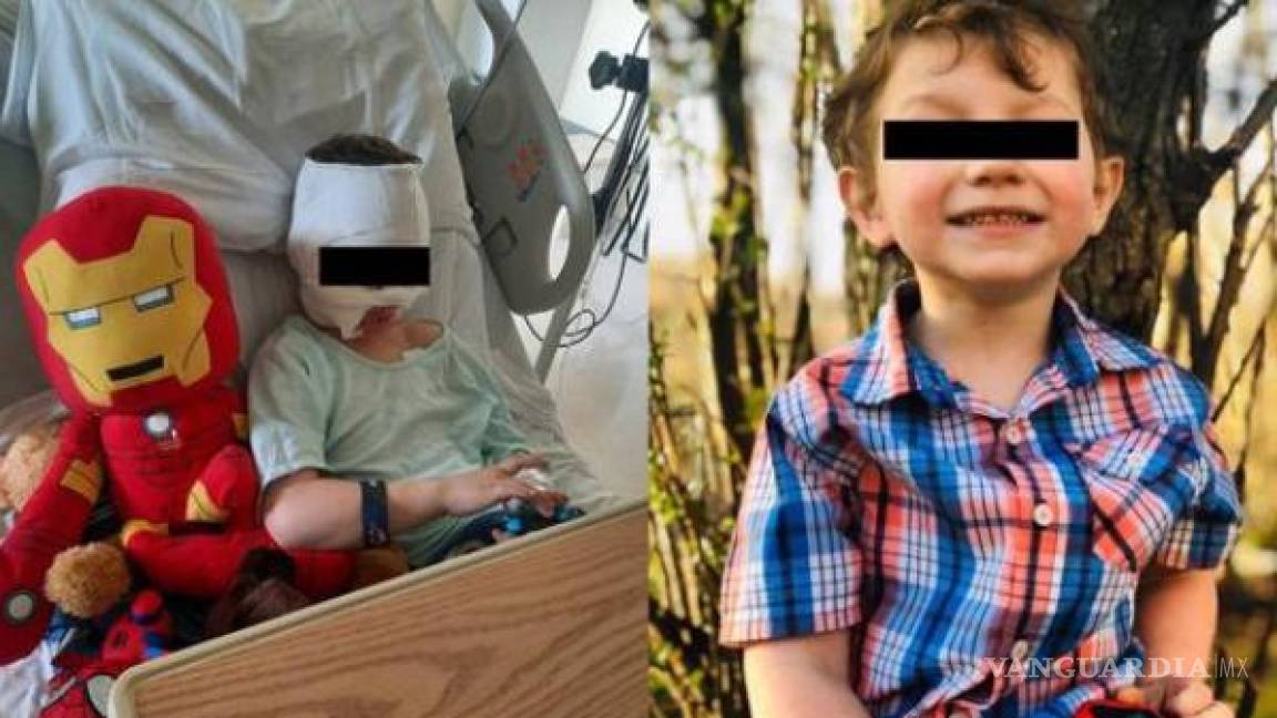 ‘Mamá, me prendieron fuego’: Niño de 6 años termina con graves quemaduras tras ataque por bullying en EUA