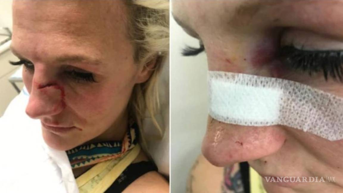 La brutal agresión de una peleadora de MMA a manos de su exnovio