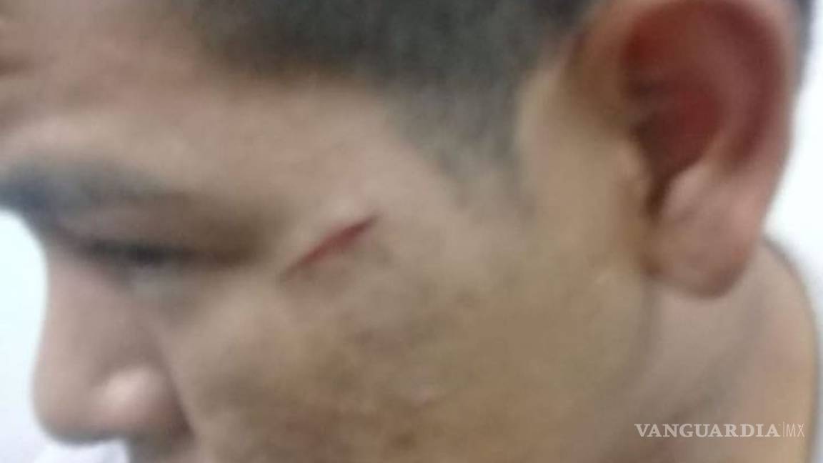 $!Su padre violó a su hija, él lo mata a machetazos