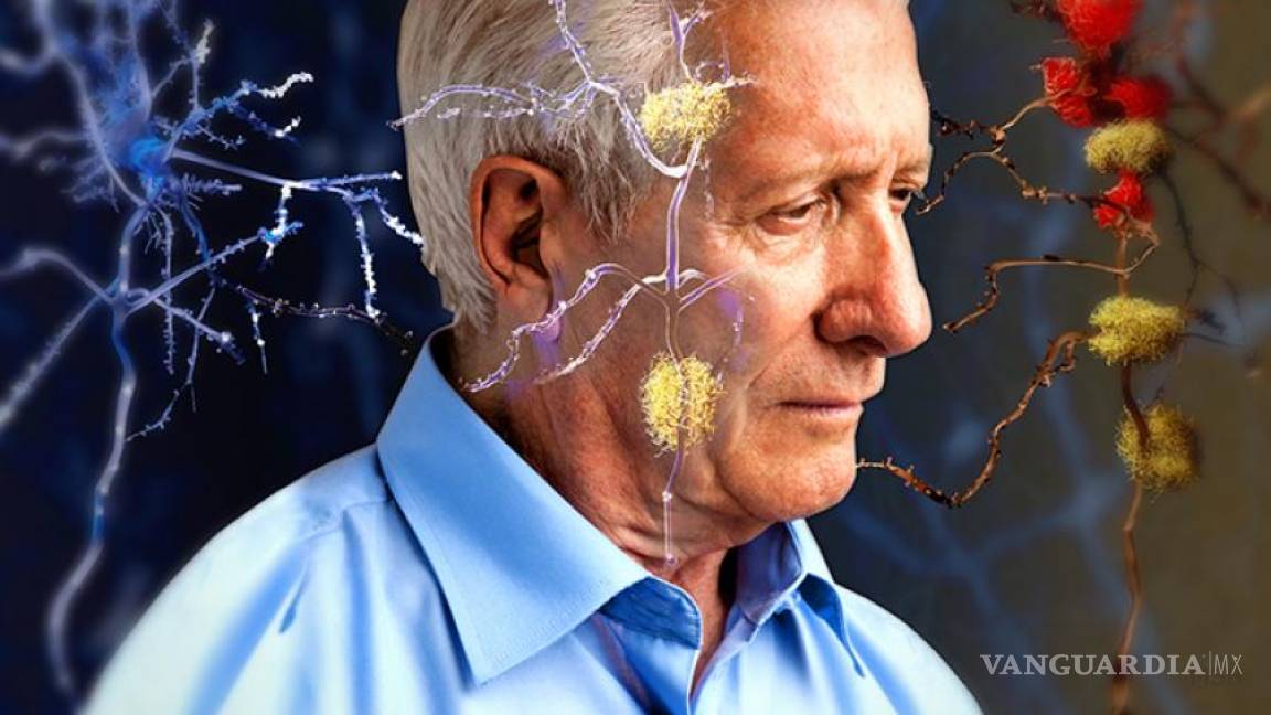 Vacuna de ADN podría retrasar aparición de Alzheimer
