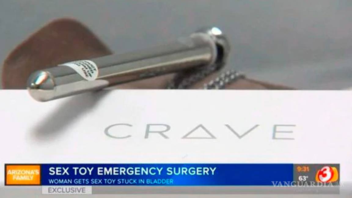 $!Juguete sexual llegó hasta su vejiga, tuvo que ser operada de emergencia