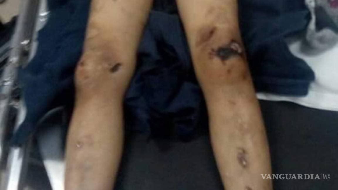 $!Pareja del mismo sexo asesina a su hijo por negarse a vestir como niña en Guanajuato