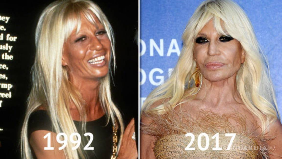 $!¿Una cirugía más? Axl Rose y Mickey Rourke lucen irreconocibles