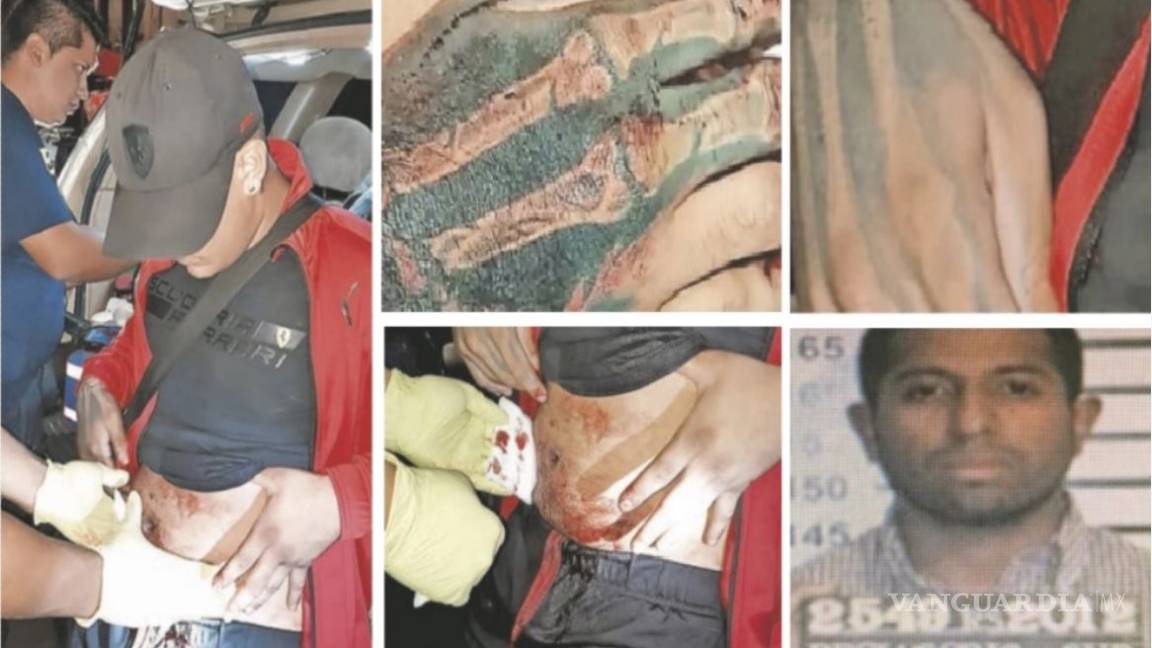 Sobrino de 'La Pulga', sicario de la Unión Tepito engaña a la policía y escapa de hospital en CdMx