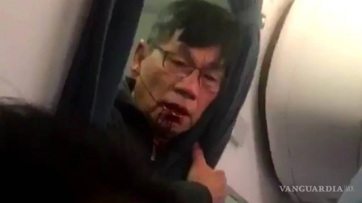 David Dao, pasajero de United Airlines, necesita cirugía reconstructiva dice su abogado