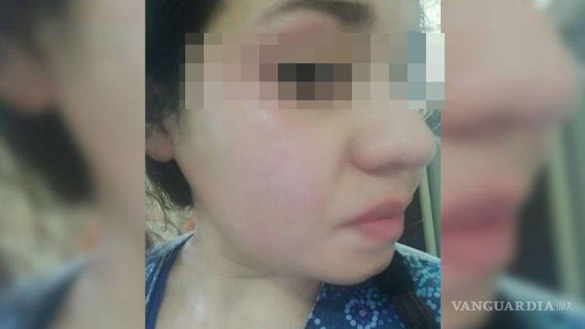 Enfermera de Piedras Negras es golpeada y acosada sexualmente al salir de su trabajo