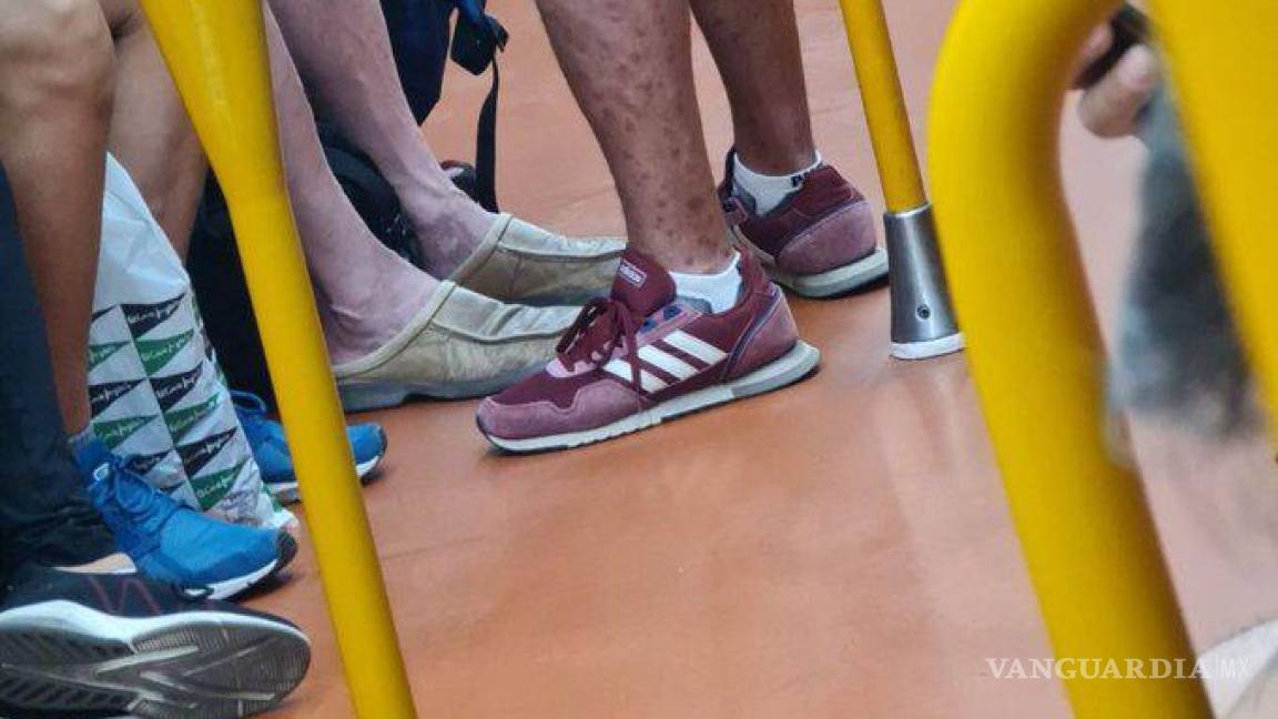 Contagiado de viruela del mono viaja en Metro de España, ‘como si nada’
