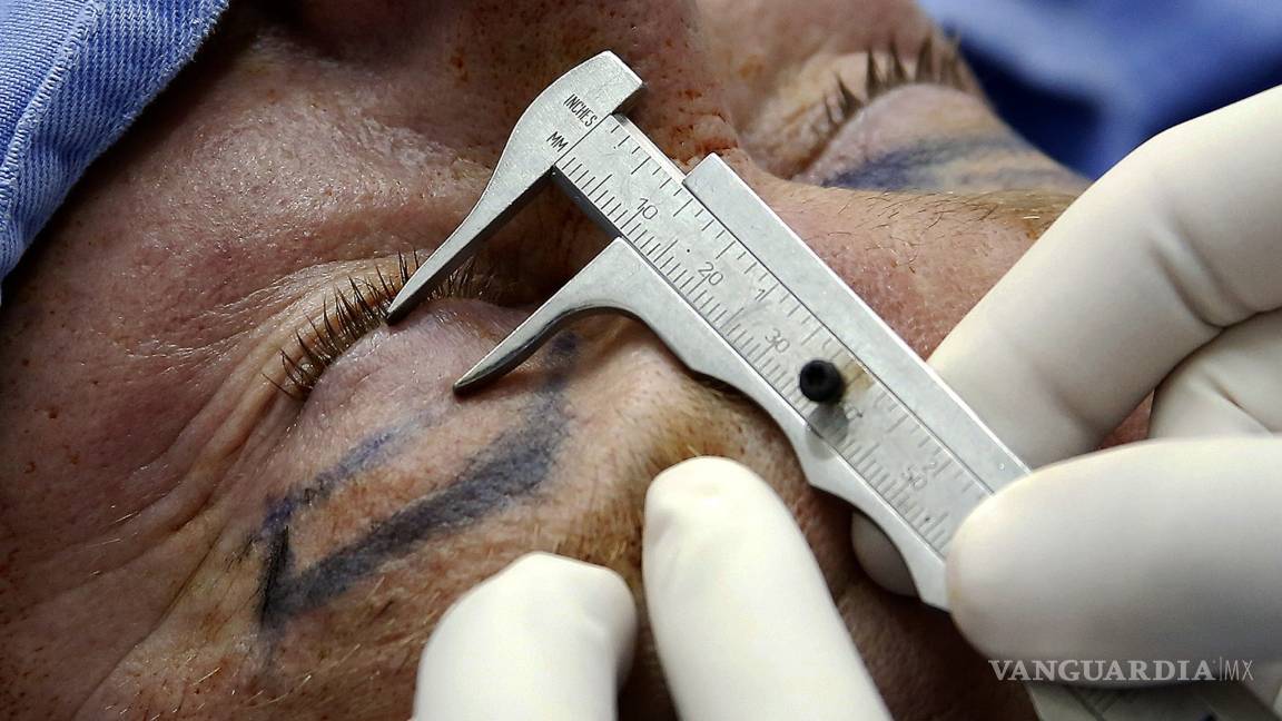 $!Fenómeno “incel”, la evolución en la cirugía estética masculina