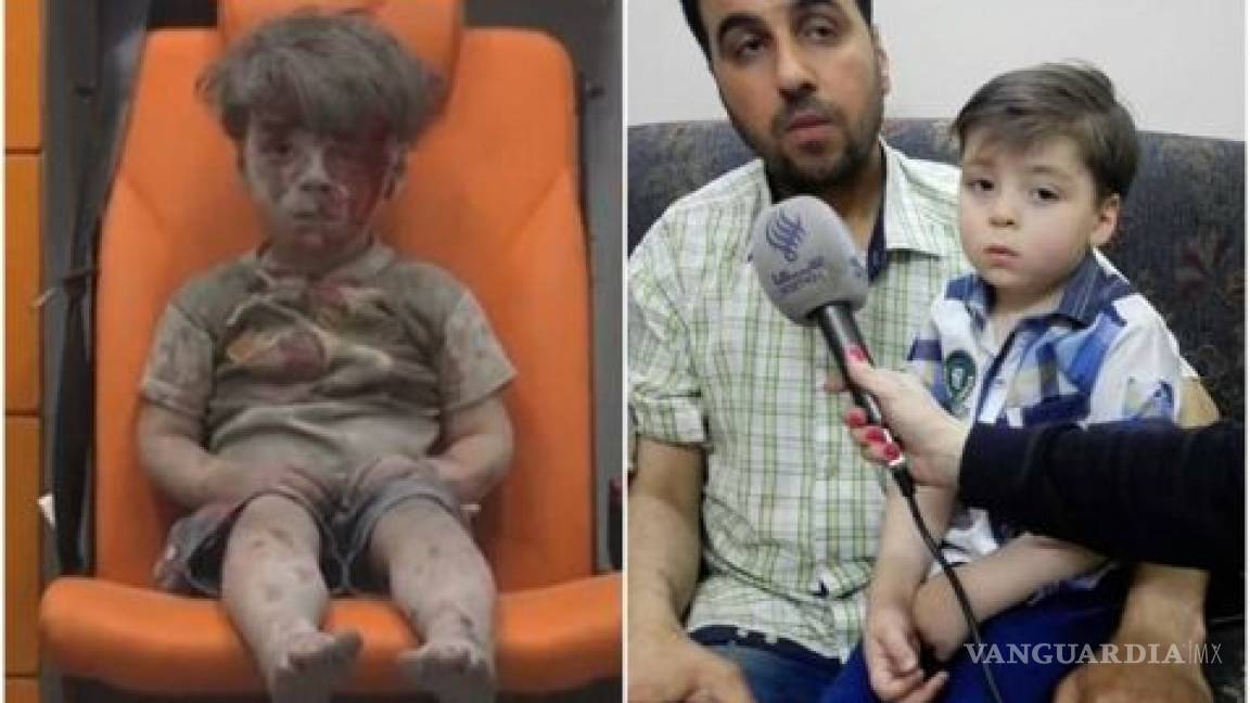 Omran Daqneesh, 10 meses después de sobrevivir a bombardeo en Siria