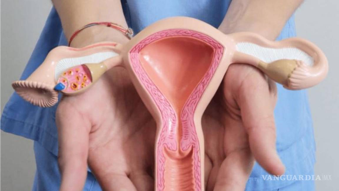 Endometriosis la terrible enfermedad que padecen 35% de las mexicanas
