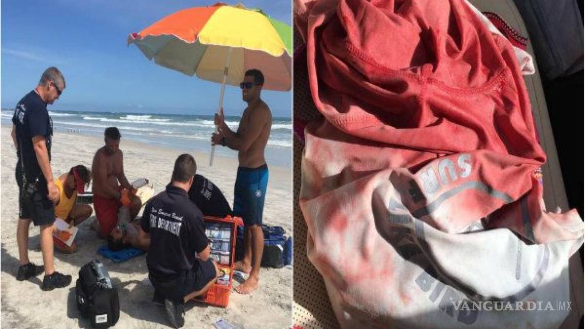 Tiburones atacan a tres surfistas en playa de Florida