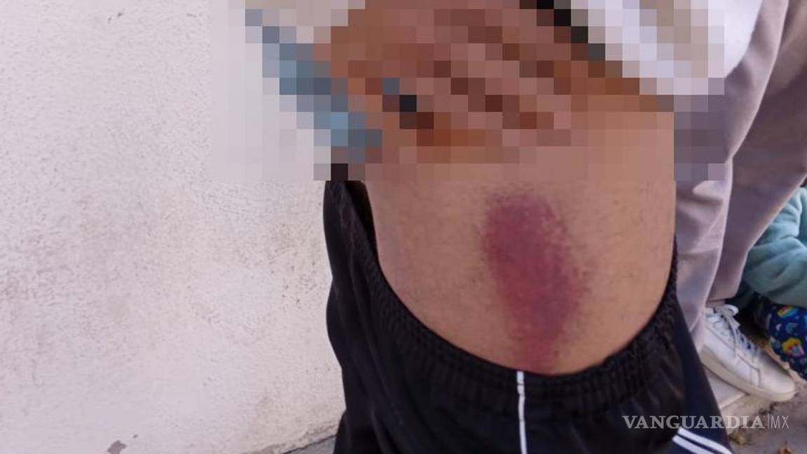 $!Autoridades rescataron a internos del centro de rehabilitación “Tú Decides Cómo Vivir” tras recibir denuncias de maltrato físico y condiciones inadecuadas.