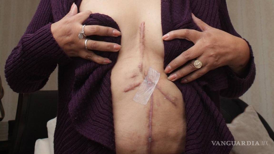 $!Violencia de género: Angélica sobrevive a 37 puñaladas