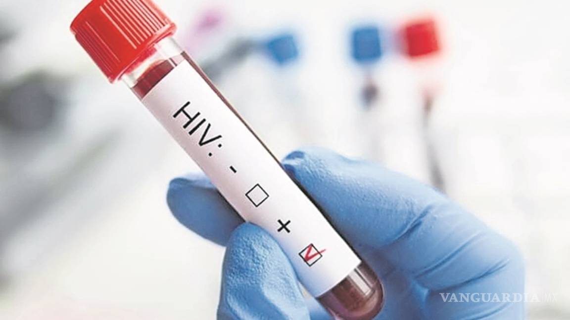 En peligro los avances contra el VIH por la lucha contra el COVID-19