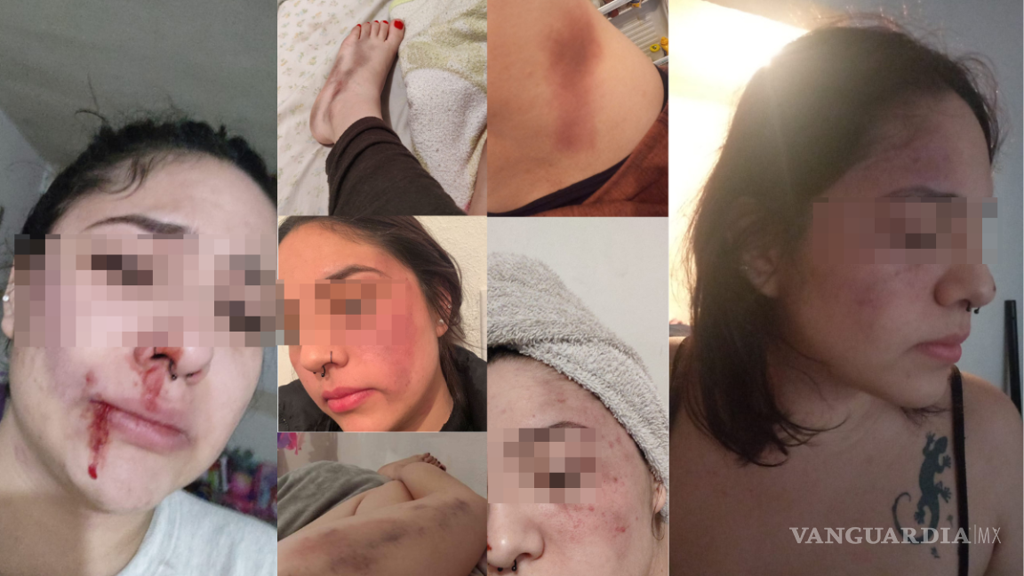 $!La joven ha sufrido diferentes atentados físicos en su contra, los cuales le han dejado secuelas en rostro y partes del cuerpo.
