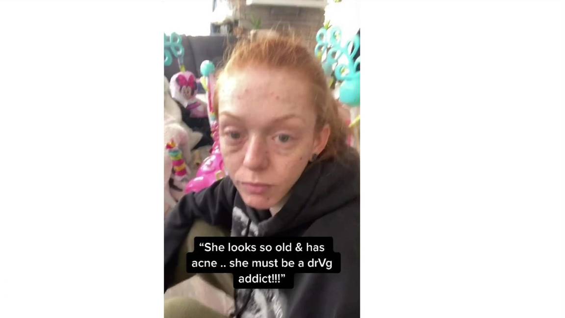 $!Ser madre le ha su robado juventud, asegura joven de 22 años, le dicen que ‘parece adicta’