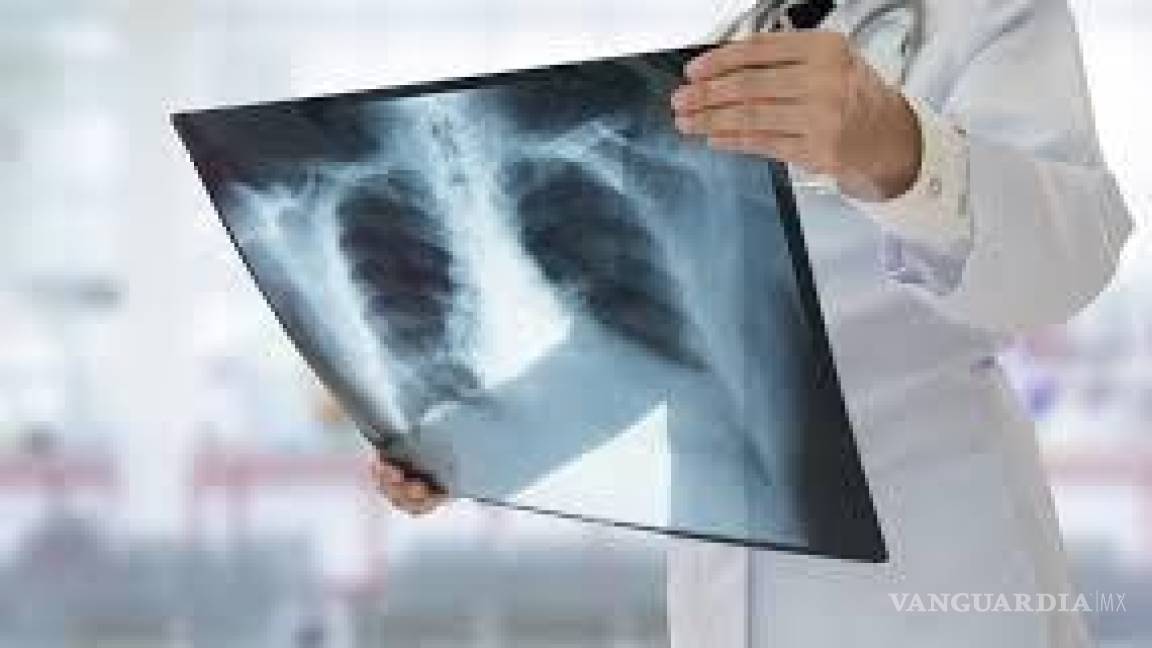 Confunden síntomas de tuberculosis con COVID-19 en Coahuila
