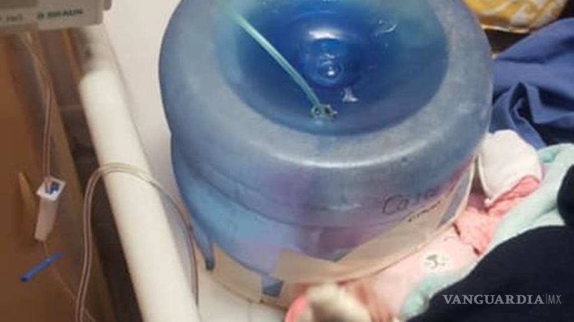 Hospital de Sonora usó un garrafón como casco de oxígeno para bebé