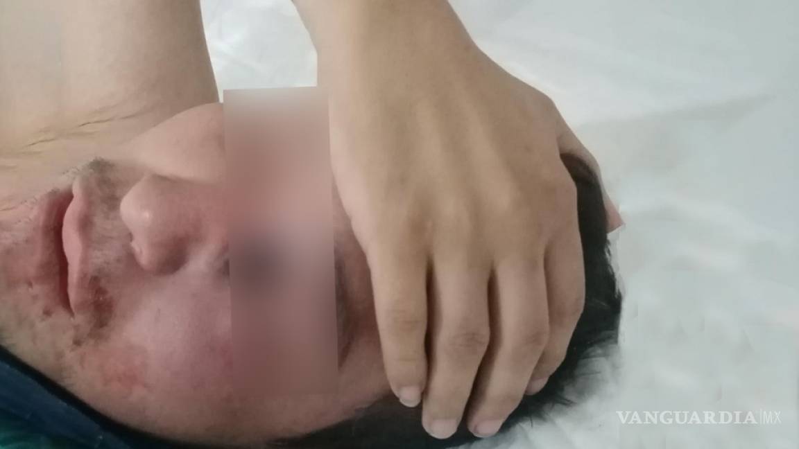 Gregorio perderá el ojo izquierdo por 'hongo negro'; infección ligada al covid-19