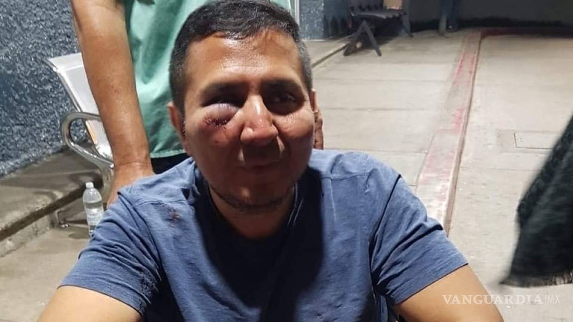 'Levantan' y golpean a periodista en Baja California Sur