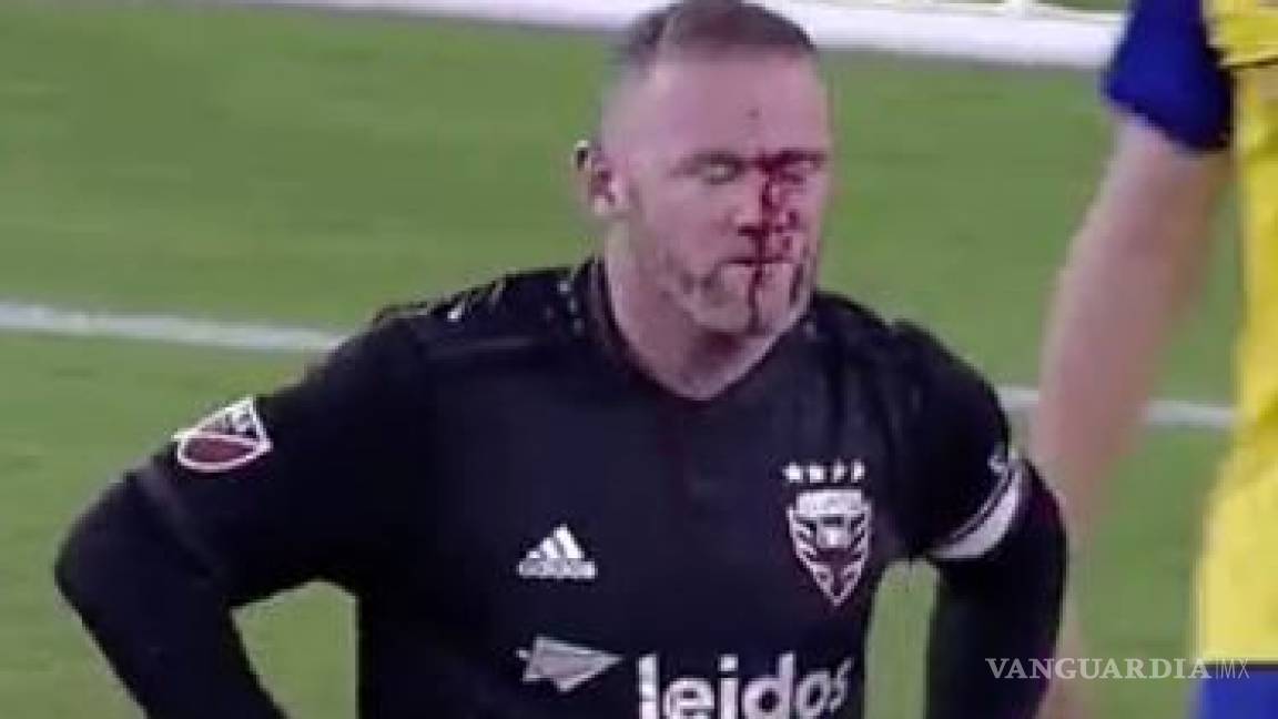 Rooney anota su primer gol en la MLS pero le cuesta sudor y sangre... mucha sangre