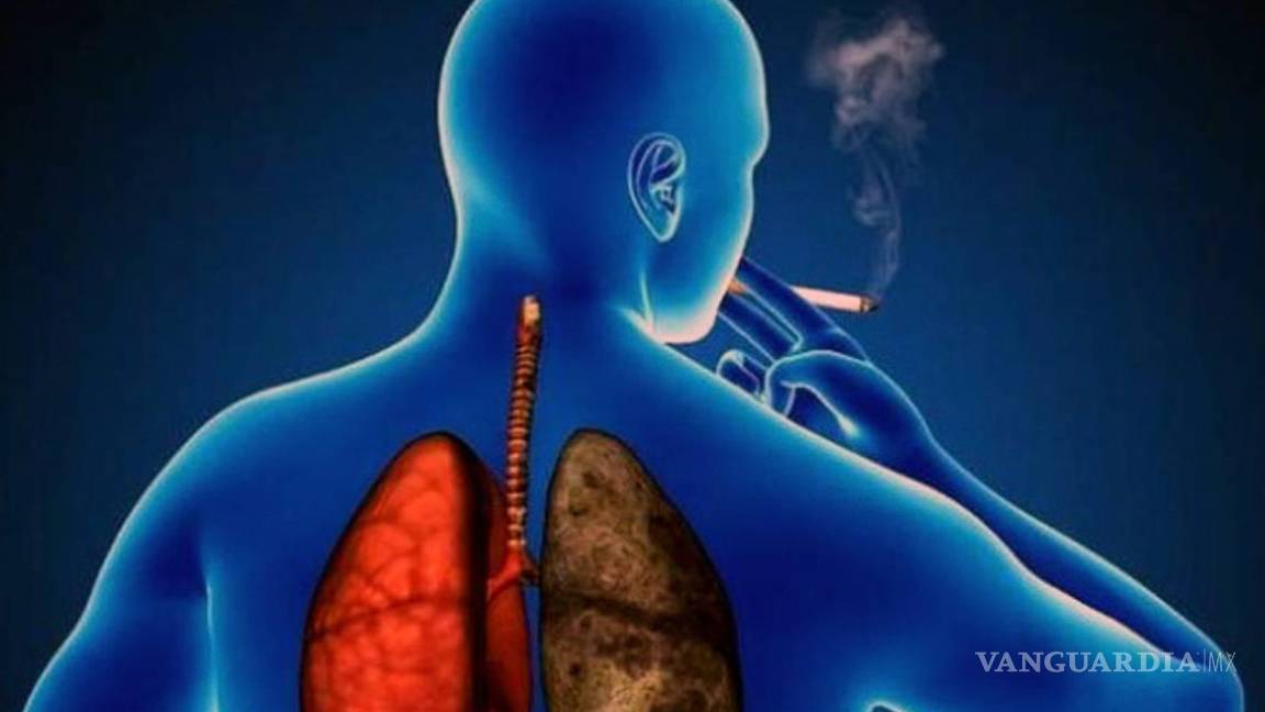 Cáncer de pulmón, con una letalidad del 95 por ciento en Coahuila
