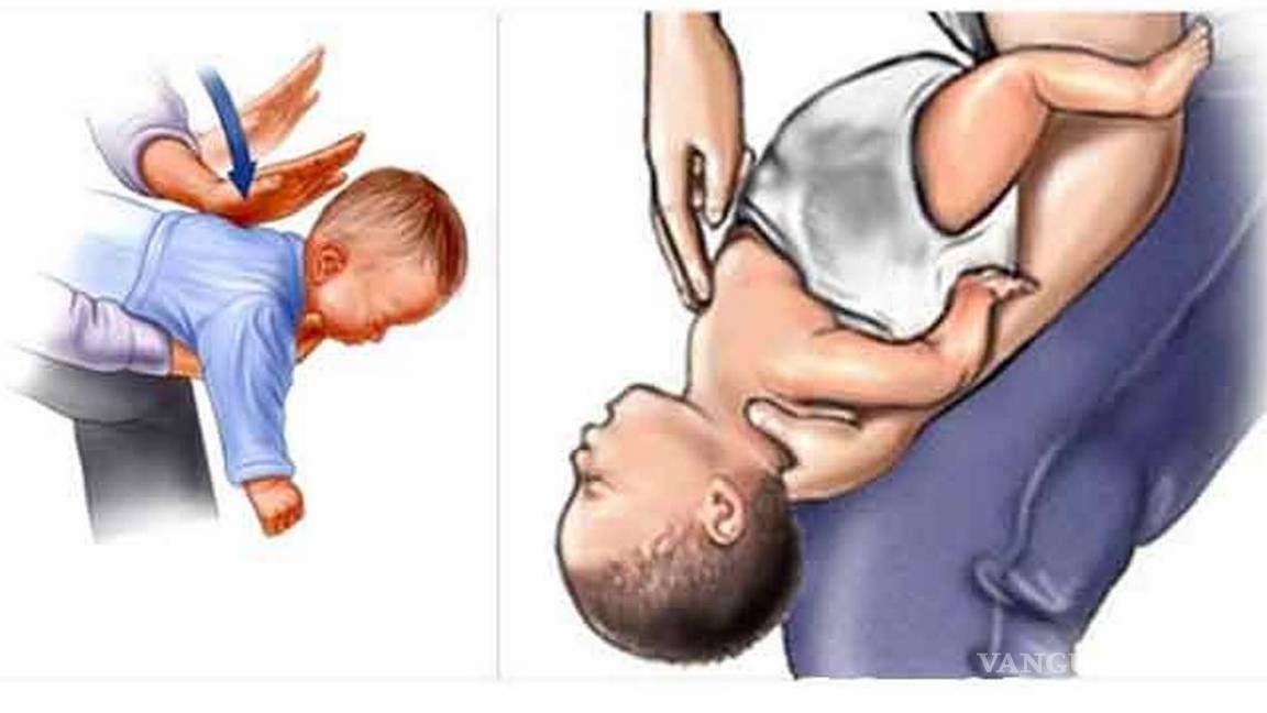 $!Tras las cinco palmadas interescapulares, debes mirar la boca del bebé para ver si se observa el objeto y, si es fácilmente accesible, cogerlo y sacarlo.