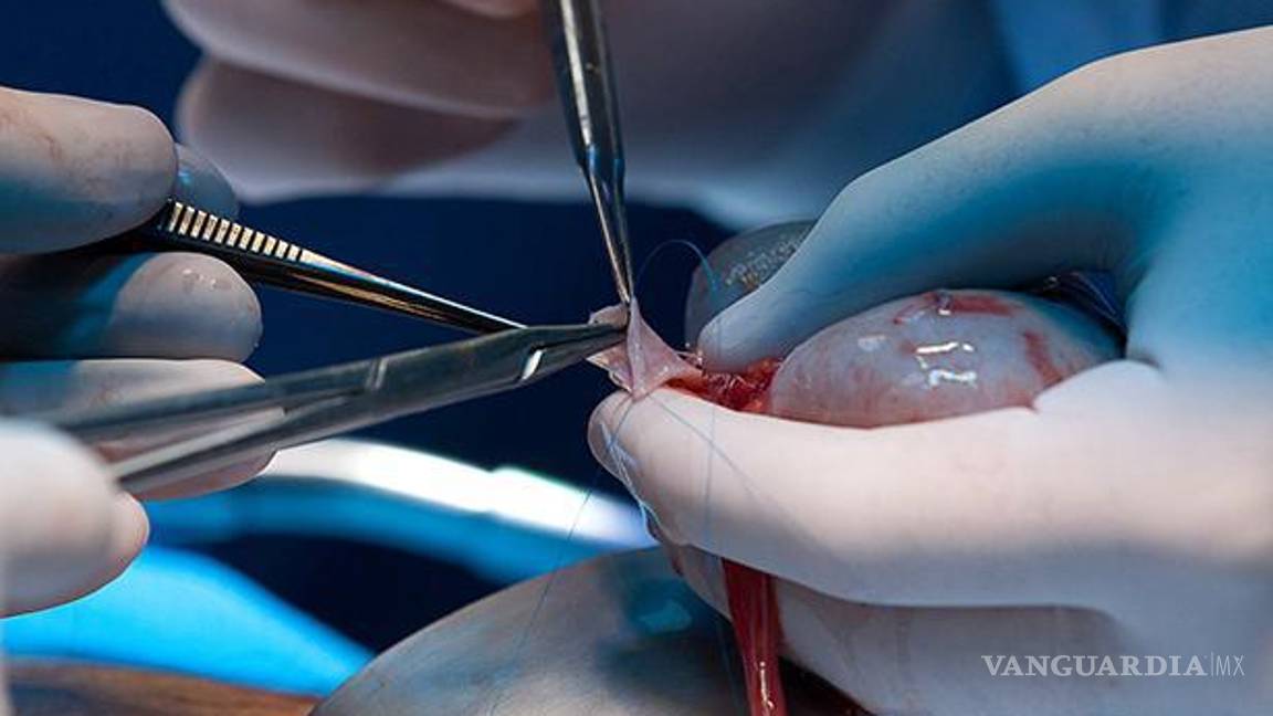 $!Los malos hábitos podrían desencadenar en complicaciones como la hemodiálisis e incluso la necesidad de un trasplante.