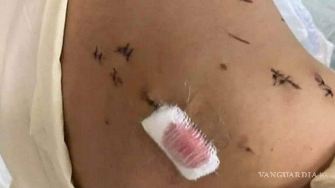 $!Tras el reclamo público, la Fiscalía General del Estado, Zona Centro, reclasificó el delito por el de lesiones agravadas y violencia familiar