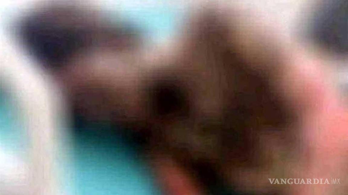 $!Muere tras ser agredida con gasolina por su pareja, en Chiapas