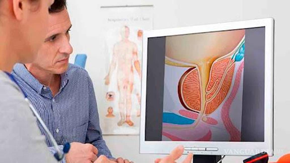 En México muere el 30 por ciento de pacientes con cáncer de próstata