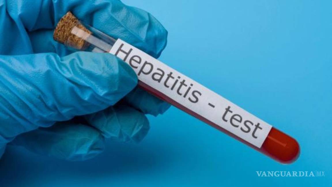 Coahuila, segundo con más casos de hepatitis A; solo Chiapas lo supera en el País