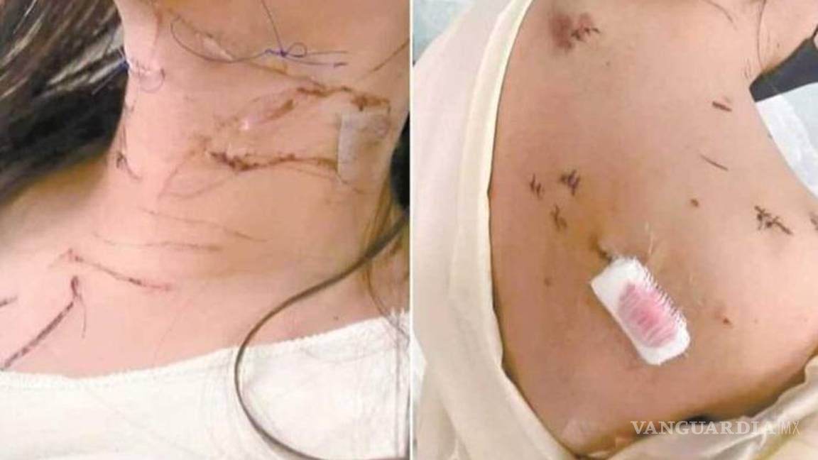 $!Erick “N” apuñaló en 47 ocasiones a Mya “N”. La subió a un auto y la abandonó en un terreno baldío. La joven logró sobrevivir tras recibir atención médica