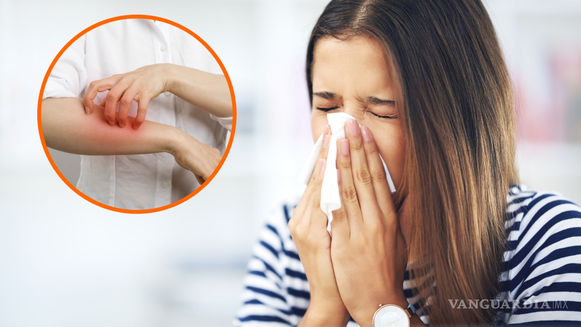 ¿Cuál es la diferencia entre las alergias y la gripe? Causas, síntomas y tratamiento