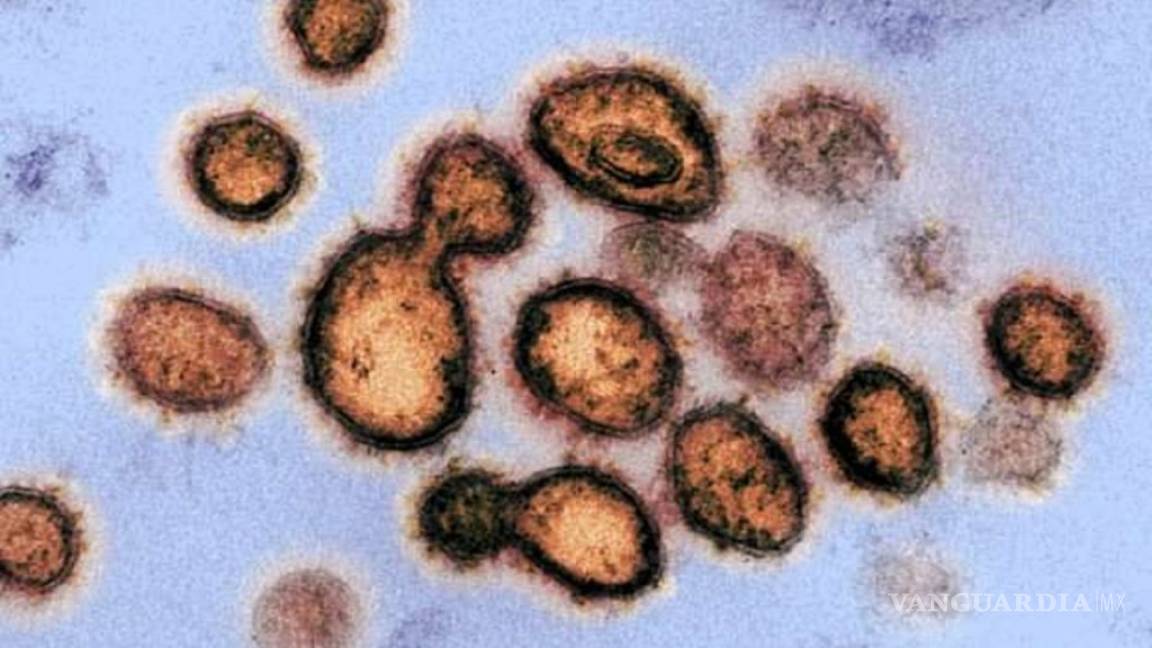 Científicos descubren anticuerpos humanos que bloquean infección del coronavirus COVID-19 en las células