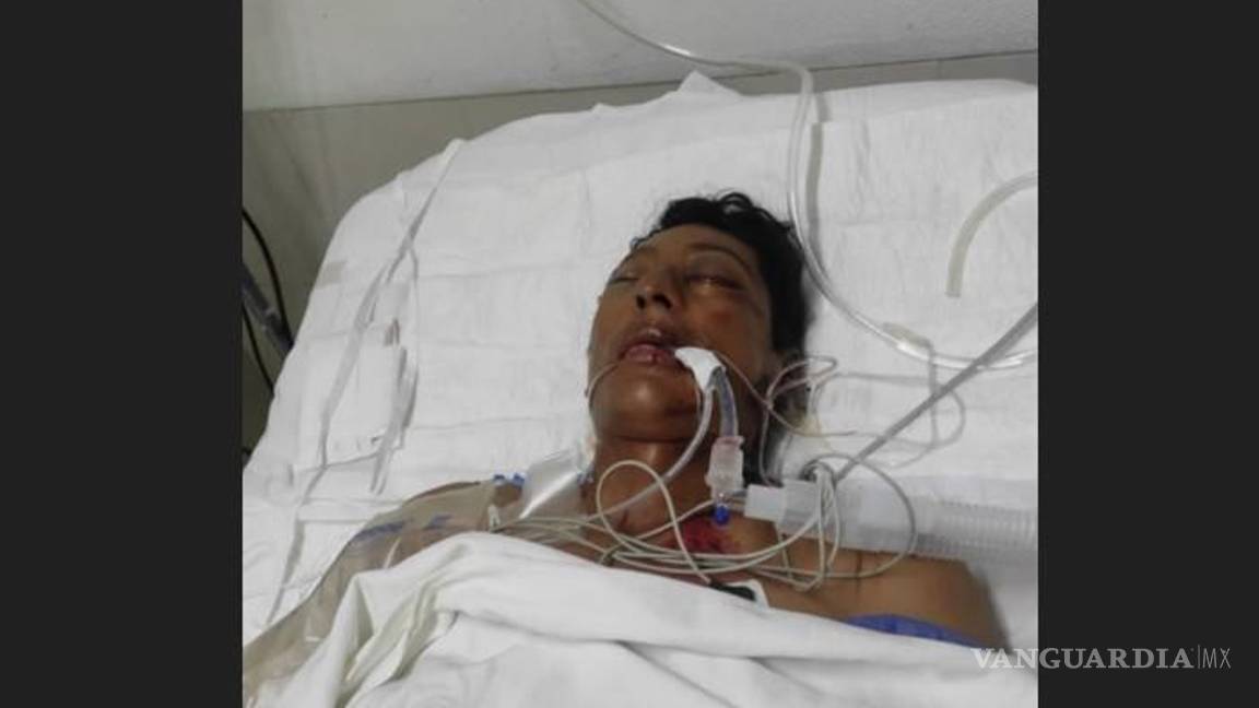 $!El joven se encuentra grave en el HG.