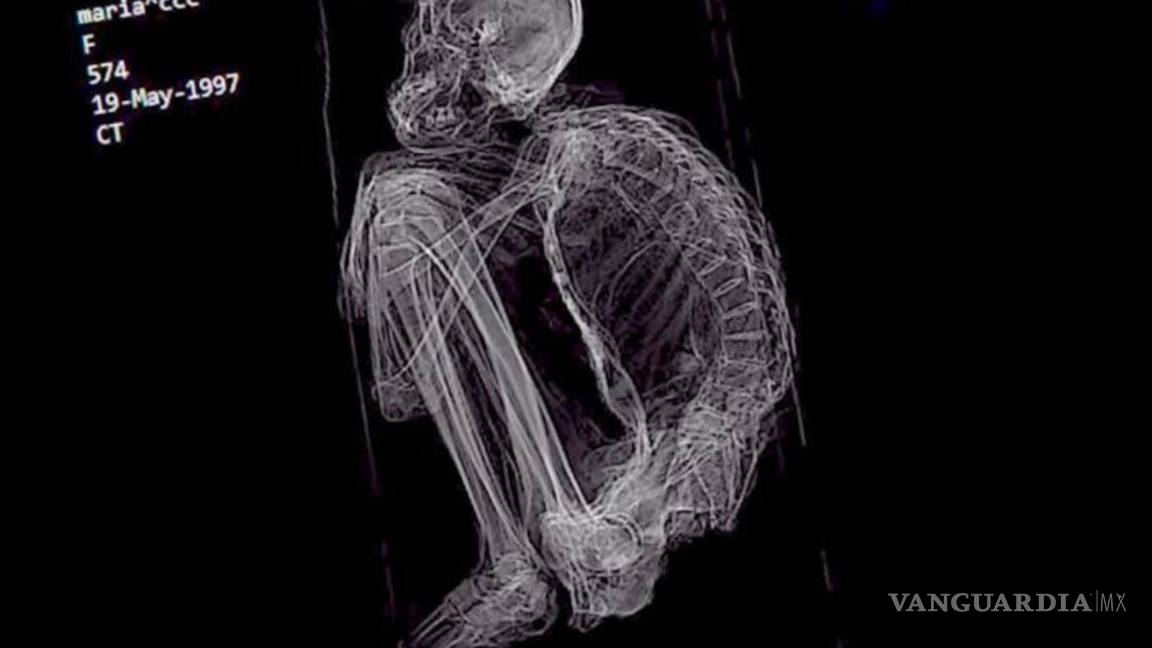 $!Descubren polémica momia "extraterrestre" en Perú