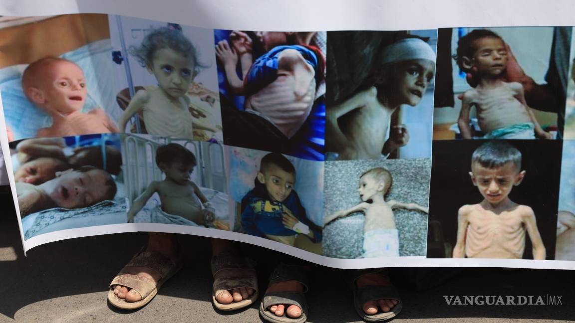 $!Manifestantes con una pancarta que muestra a niños palestinos con desnutrición severa durante una protesta para exigir el fin de la guerra en Gaza.