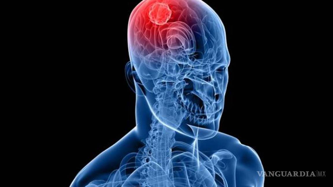 Computación para combatir cáncer cerebral