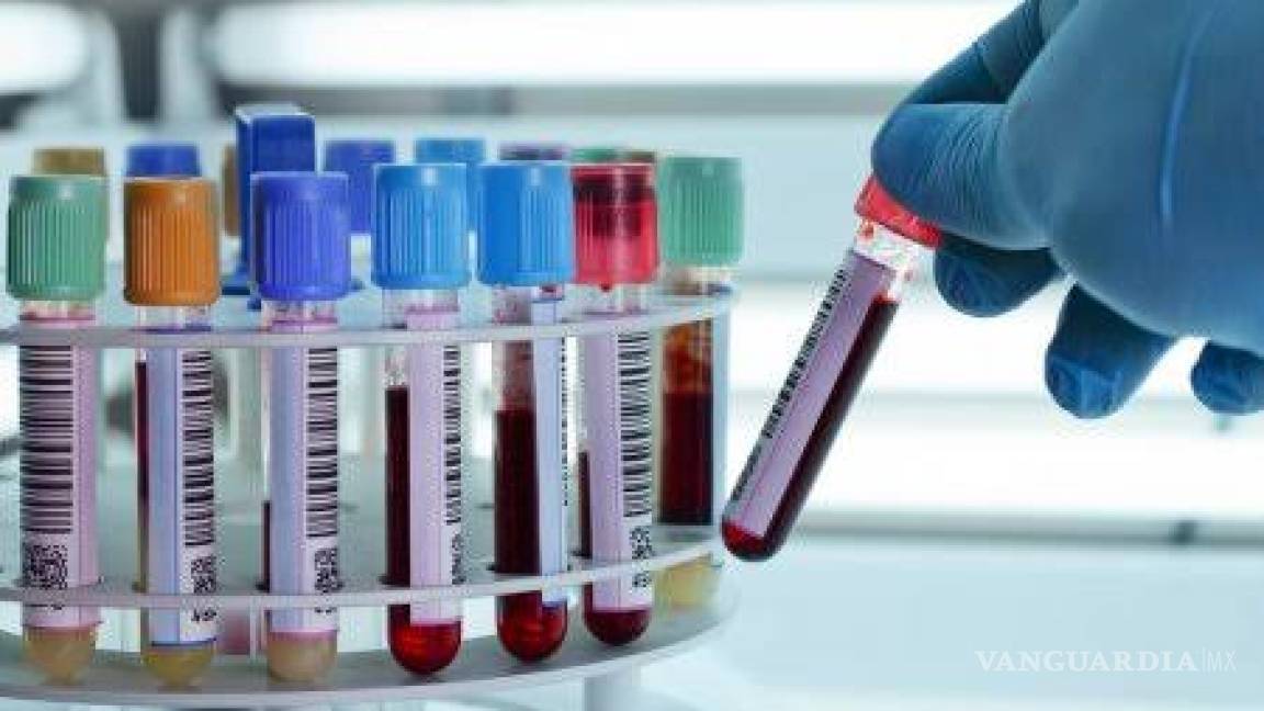 Laboratorios están saturados y no pueden con la alta demanda de pruebas del coronavirus