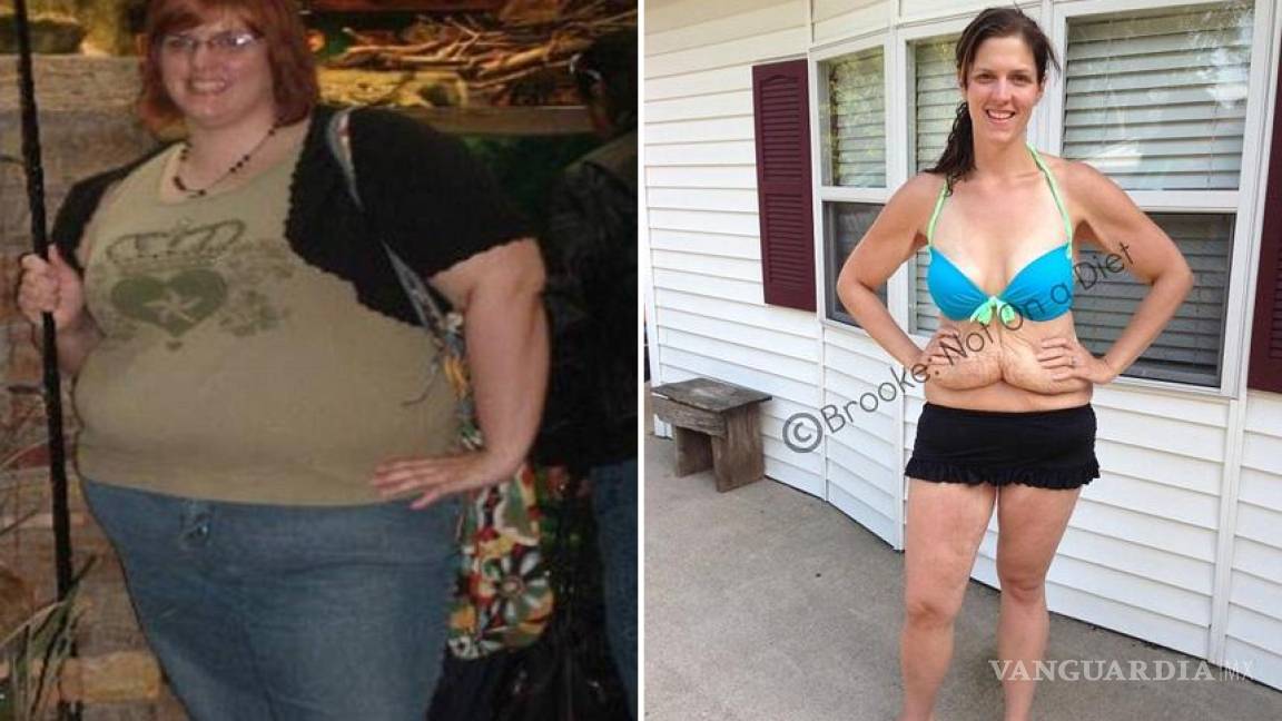Polémica por foto de mujer en bikini que bajó 78 kilos