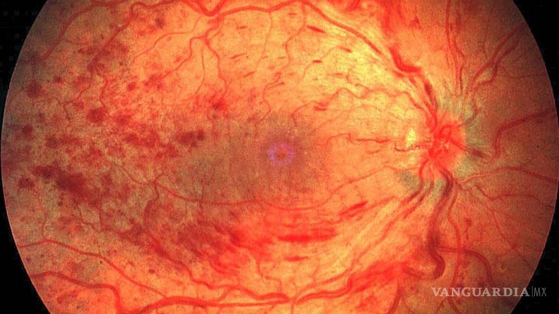 &quot;Imprimen&quot; células oculares para reparar retina dañada