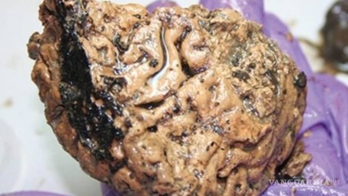 Descubren un cerebro humano de 2.600 años