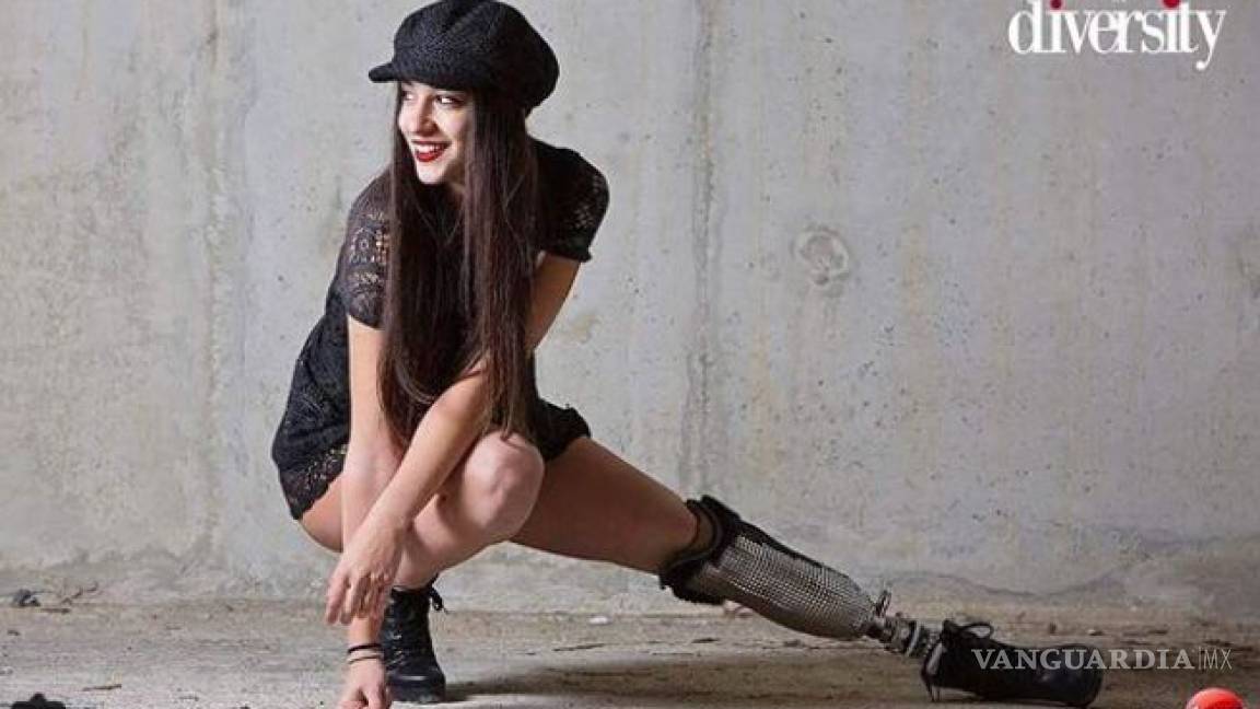 Conoce a Chiara Bordi, la aspirante a Miss Italia que no tiene una pierna